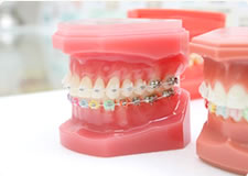 矯正歯科・カラフルな矯正装置・器具でお子様にも楽しんで治療してもらえます